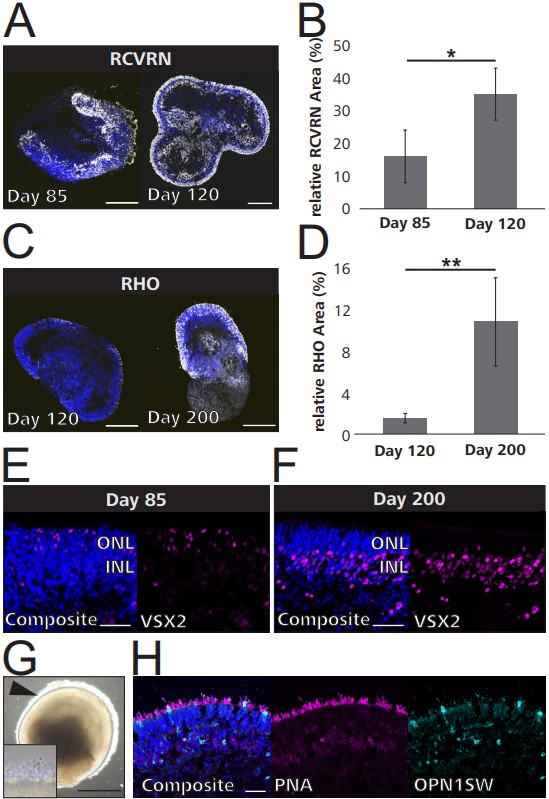 Retinal Organoid Differentiation Methods Determine Organoid Cellular