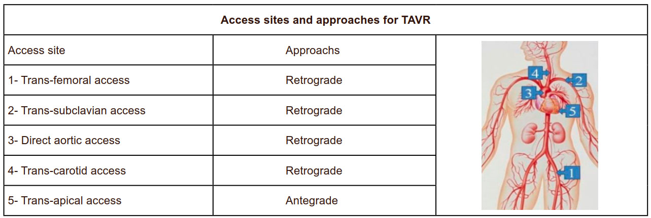  Complications Of Transcatheter Aortic Valve Replacement And Rescue Attempts