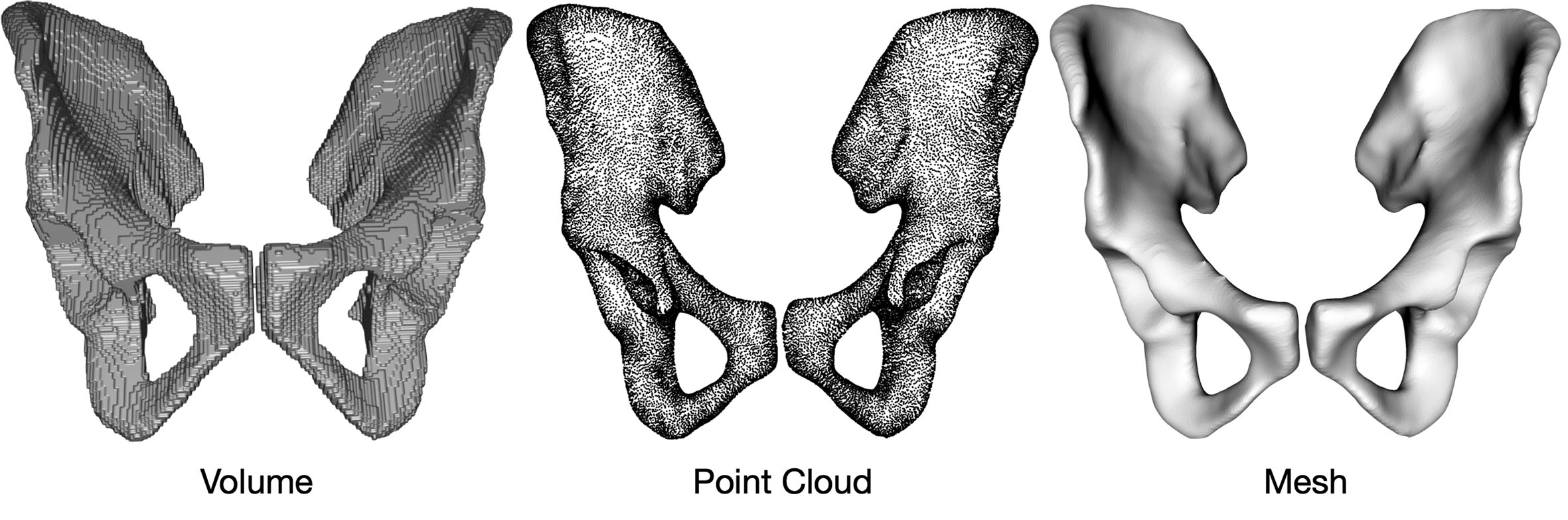 Digital twins as a unifying framework for surgical data science: the enabling role of geometric scene understanding