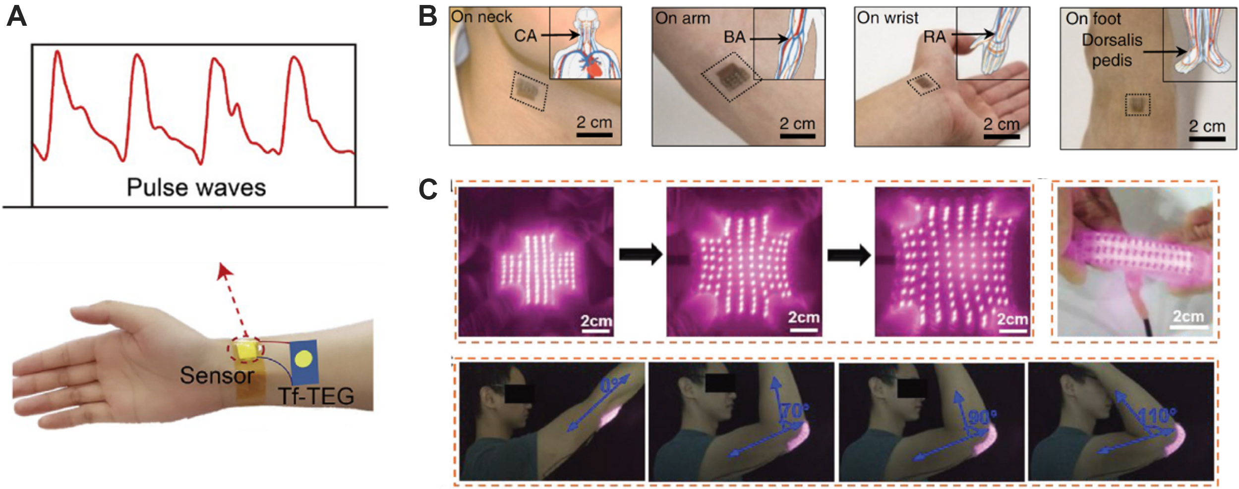 Recent Progress In Flexible Tactile Sensor Systems: From Design To ...