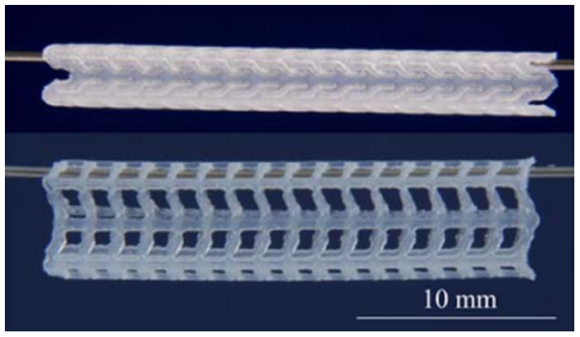 Research into biodegradable polymeric stents: a review of experimental ...