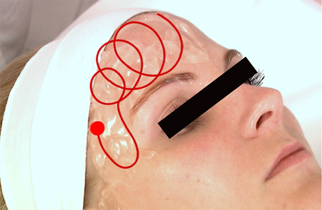 The Benefit Of Combined Radiofrequency And Ultrasound To Enhance Surgical And Nonsurgical Outcomes For The Face And Neck