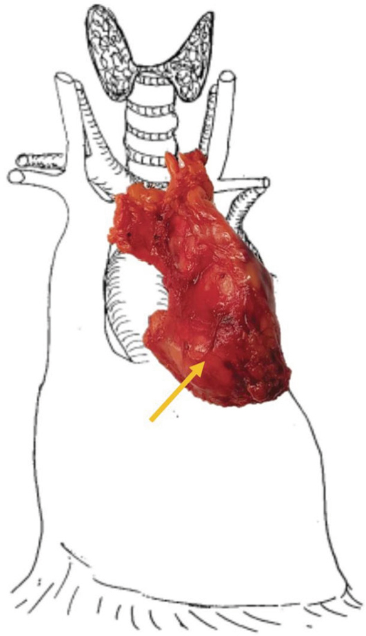 Standardized definitions and concepts of radicality during minimally