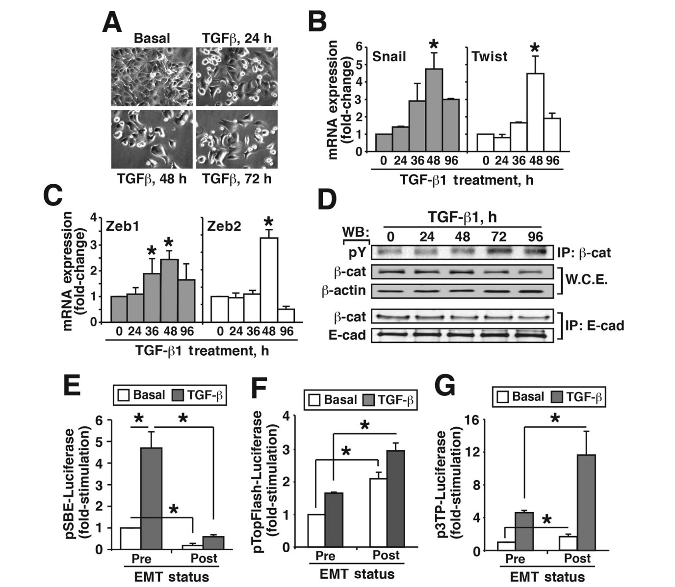 Tgf B Stimulation Of Emt Programs Elicits Non Genomic Er A Activity And Anti Estrogen Resistance In Breast Cancer Cells