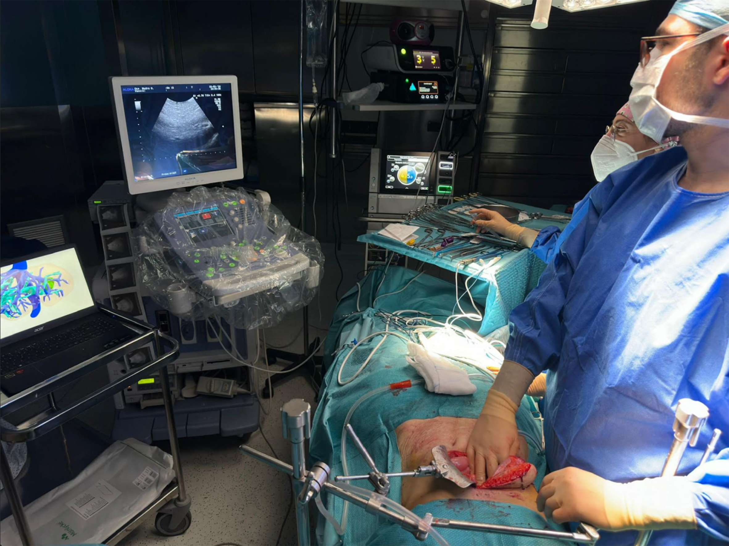 Contribution of 3D virtual modeling in locating hepatic metastases, particularly “vanishing tumors”: a pilot study