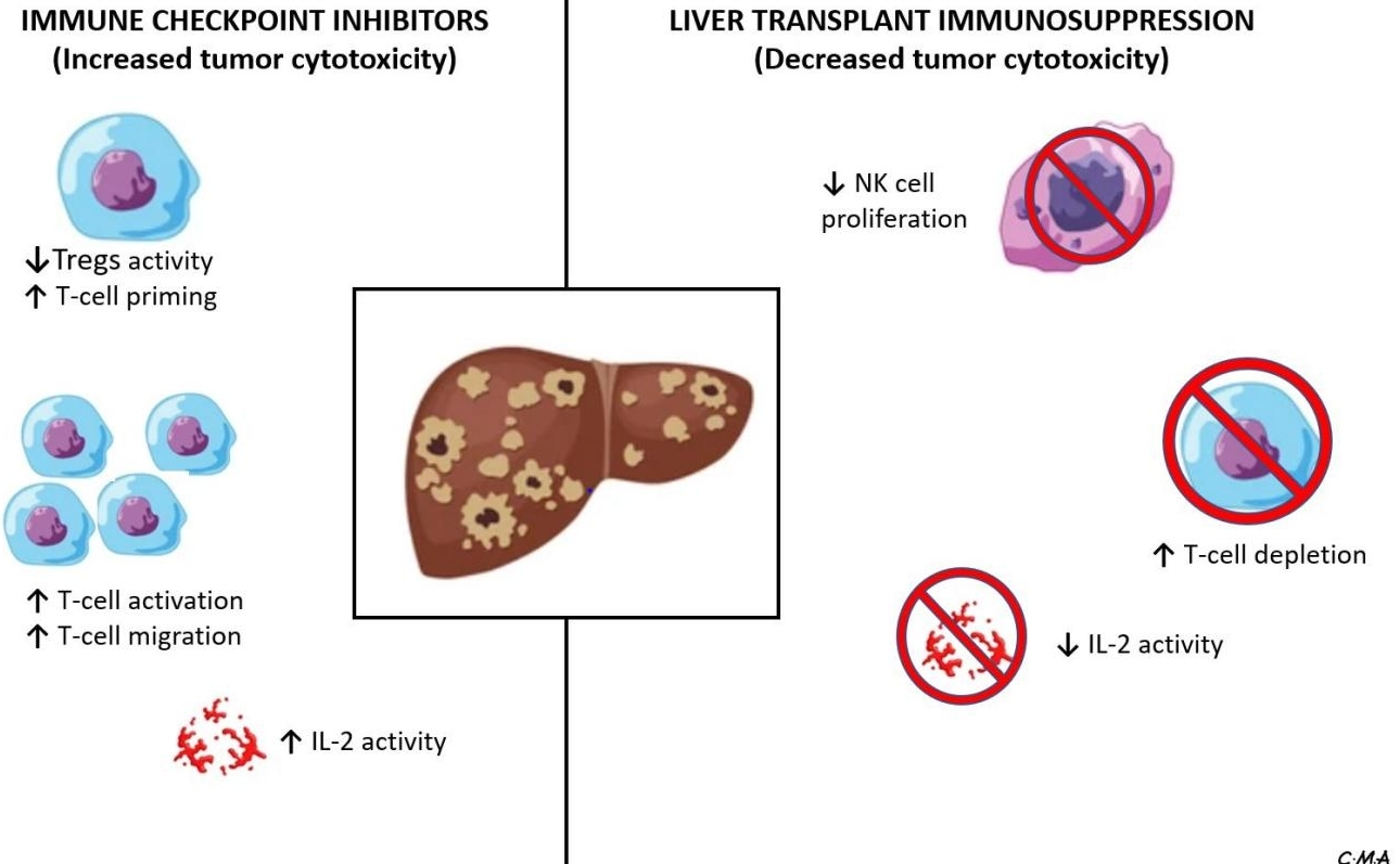 Understanding Immune Perspectives And Options For The Use Of Checkpoint Immunotherapy In Hcc 4305