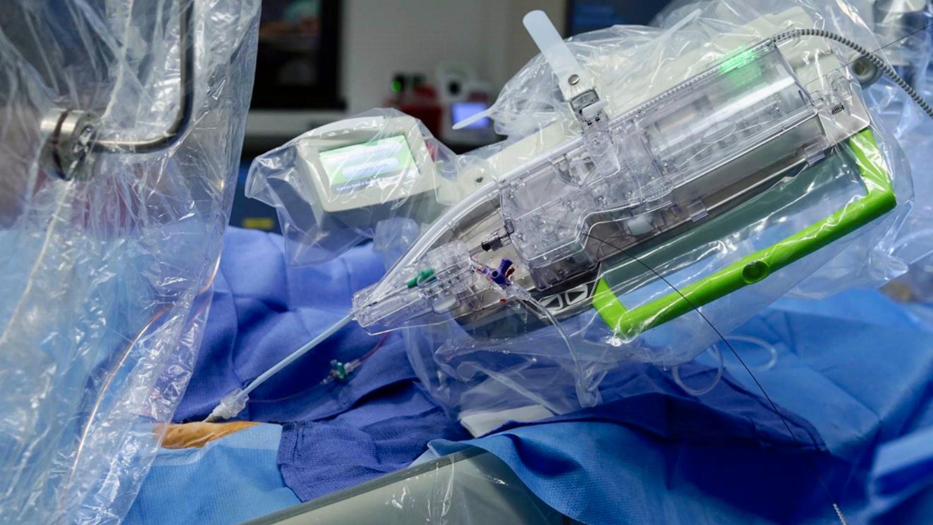 Mechanical marvels: robots in carotid artery stenting - a systematic review of effectiveness in neuroendovascular interventions