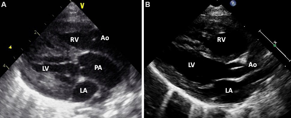 Echocardiography: an overview - Part III