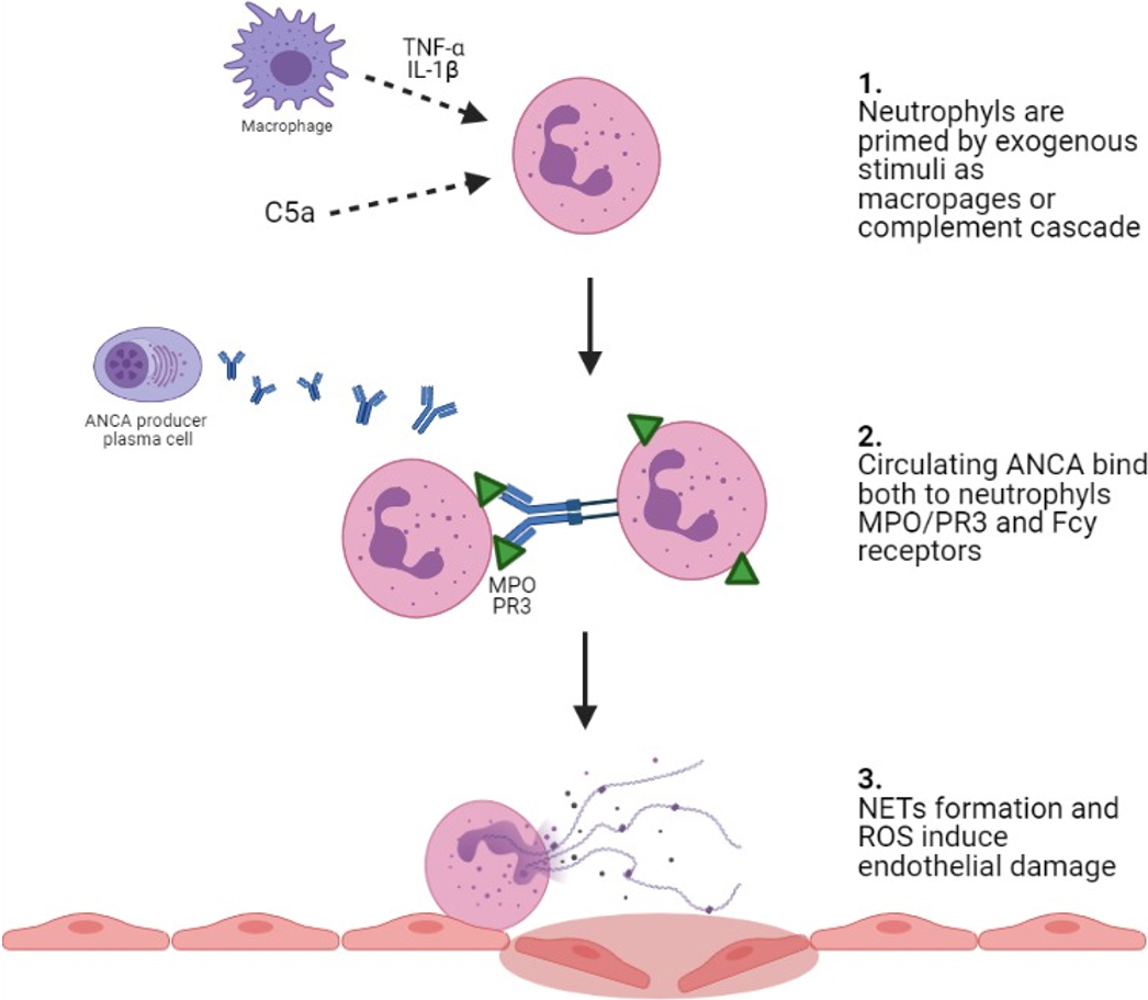 Pathogenesis and biomarkers in ANCA-associated vasculitis