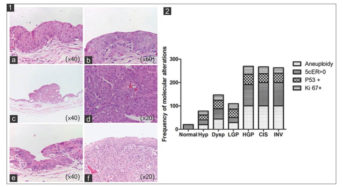 What we have learned from urinary bladder cancer models