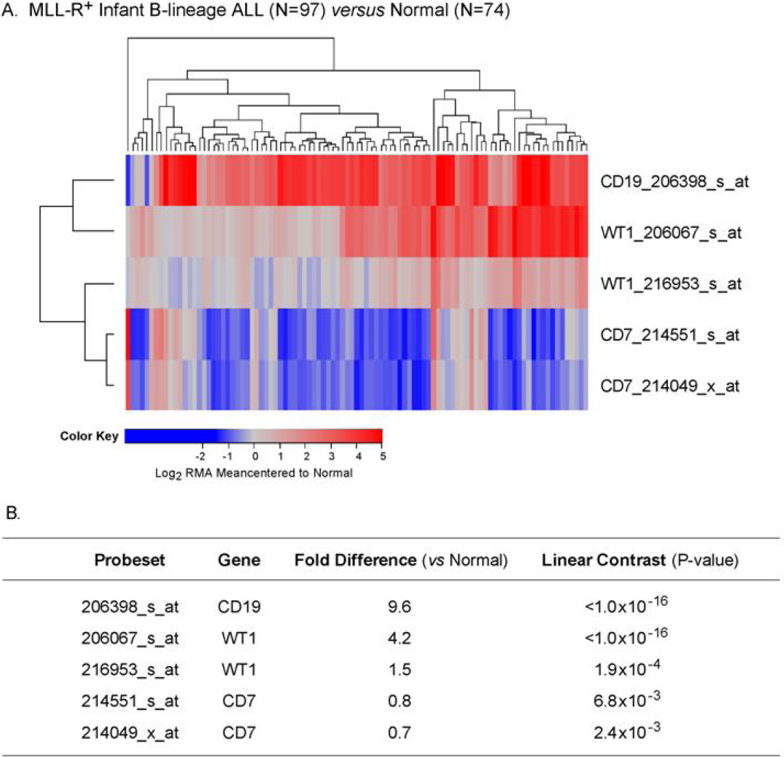 Wilms’ tumor gene ( WT1 ) is strongly expressed in high-risk subsets of