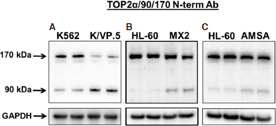 cancer drug resistance
