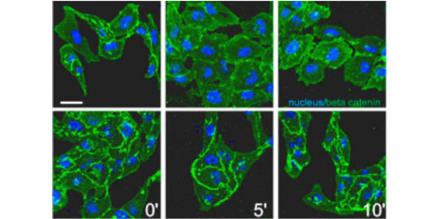 Novel Biological Mechanisms and Impact on Clinical Practice