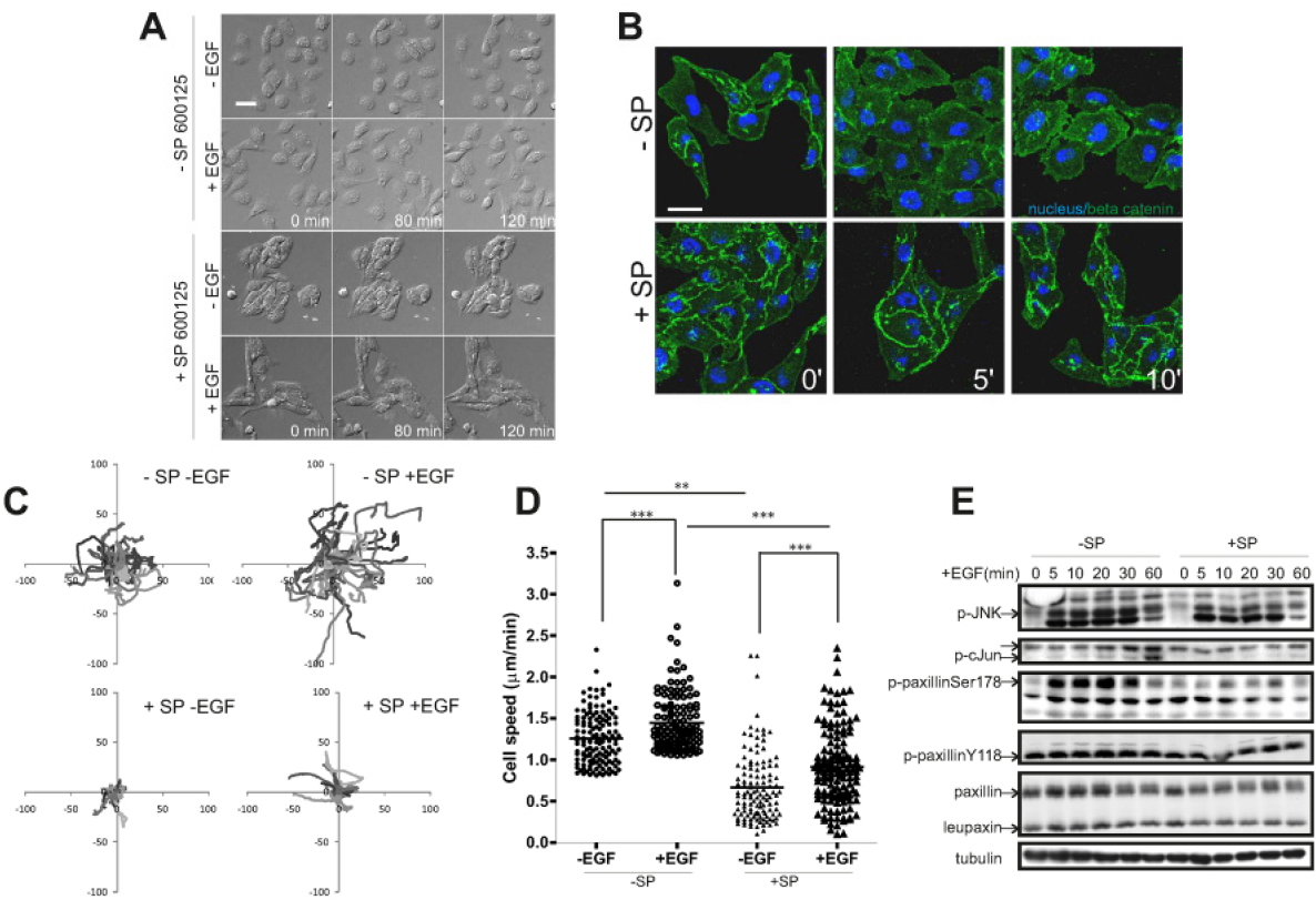 Paxillin Serine 178 Phosphorylation In Control Of Cell Migration And Metastasis Formation Through Regulation Of Egfr Expression In Breast Cancer