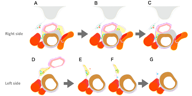 Mini-invasive Surgery