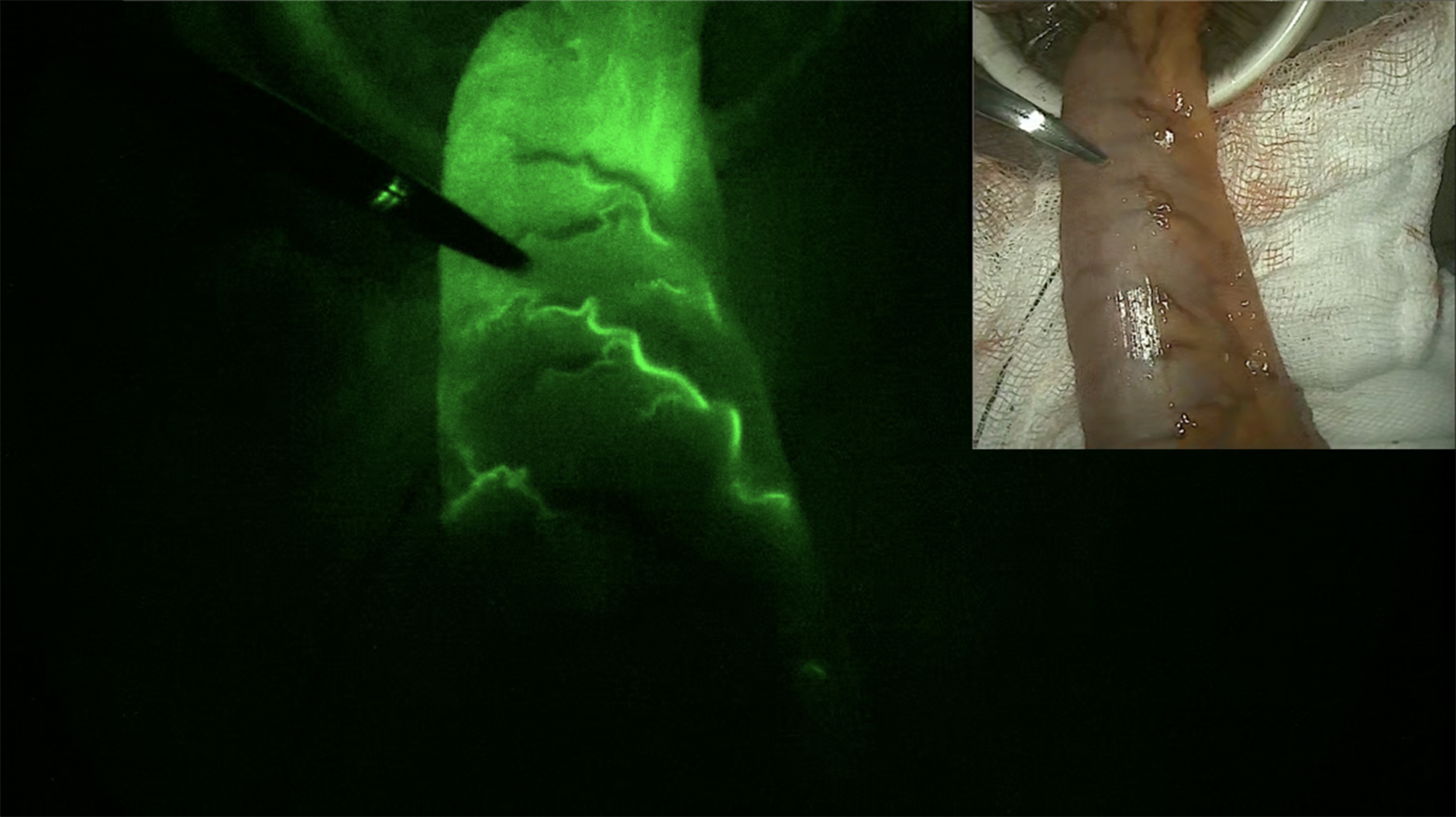 Beyond diagnosis: how advanced imaging technologies are shaping modern surgery