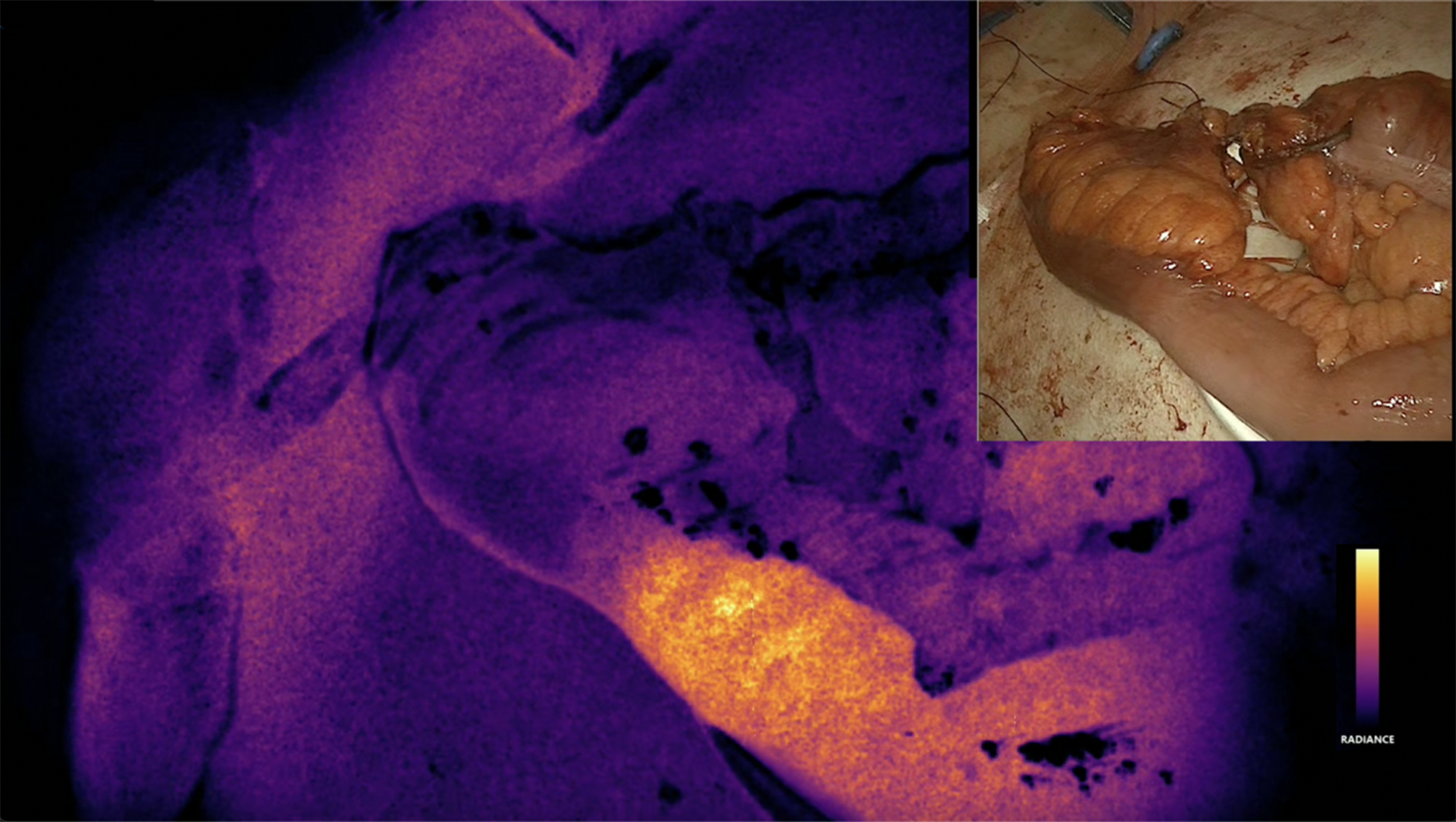 Beyond diagnosis: how advanced imaging technologies are shaping modern surgery