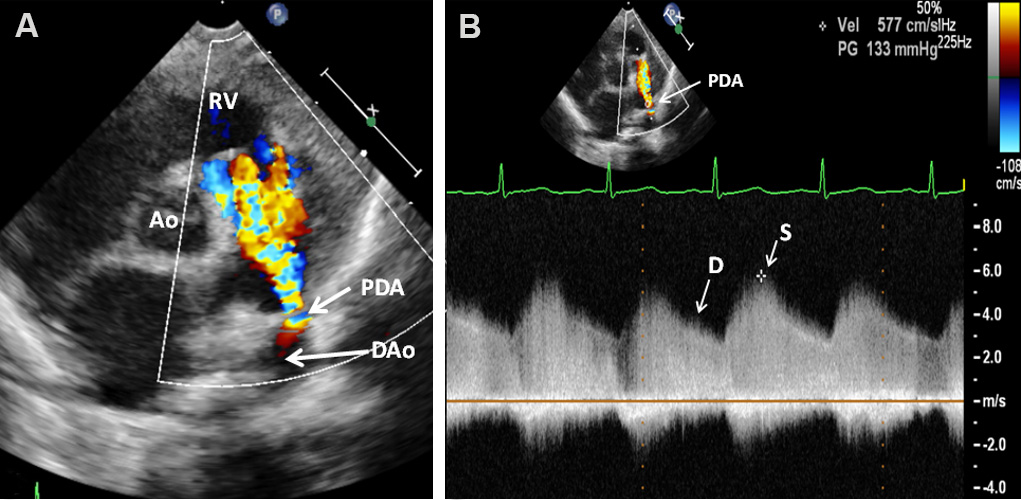 Echocardiography: An Overview - Part I