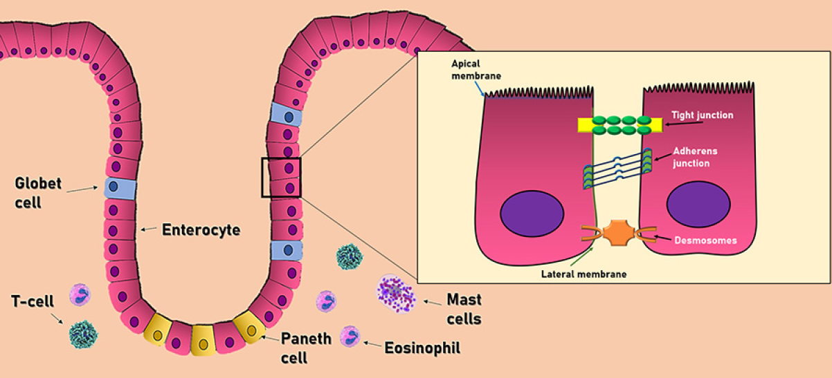 The mechanism of dysbiosis in alcoholic liver disease leading to liver ...