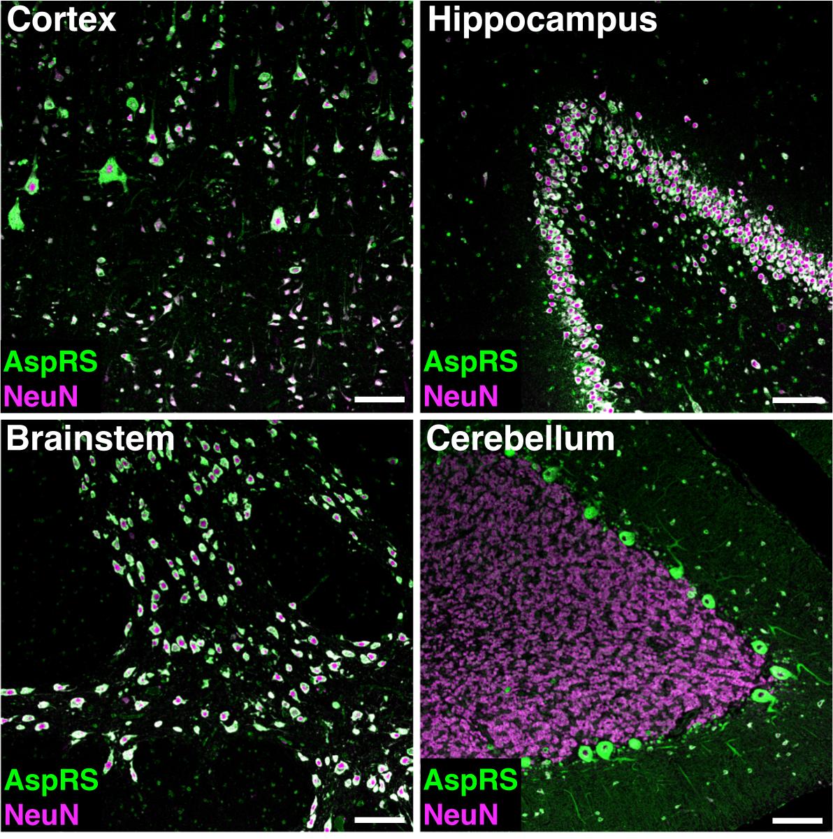 Histological and biochemical methods to assess aminoacyl-tRNA synthetase expression in human post-mortem brain tissue