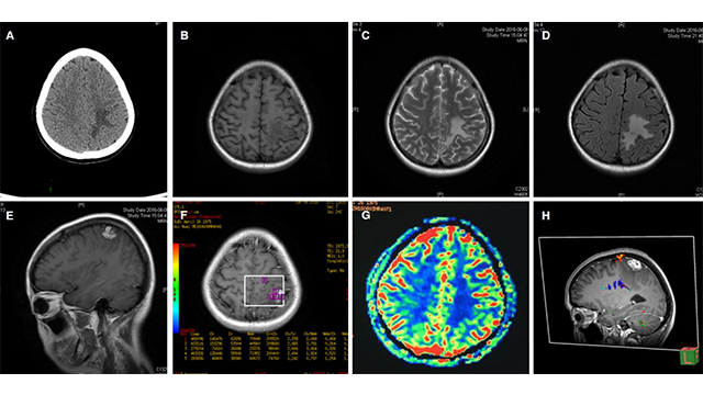 labeled diagrams human brain 444 x 444 70 kb jpeg brain lobeshome · labeled diagrams human brain 444 x 444 70 kb jpeg brain lobes labeled · neuroimmunology and neuroinflammation